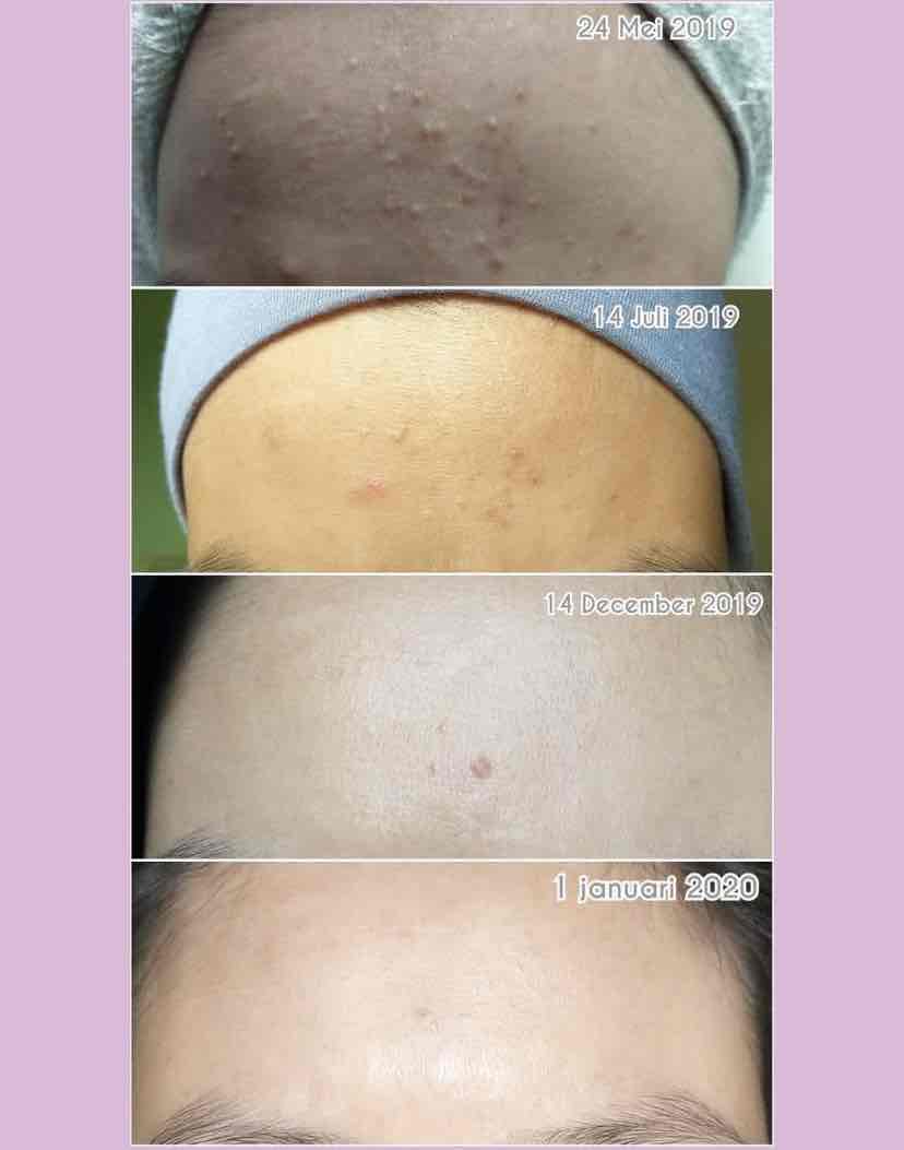 Goodbye Bumpy Skin! The Routine That Leaves Your Skin Super Smooth cover photo collage