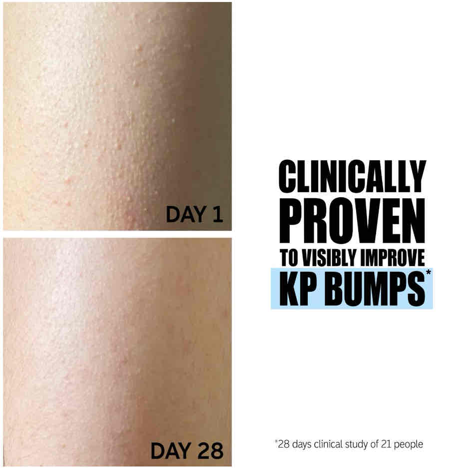 Say goodbye 👋🏻 to strawberry skin/ KP cover photo collage