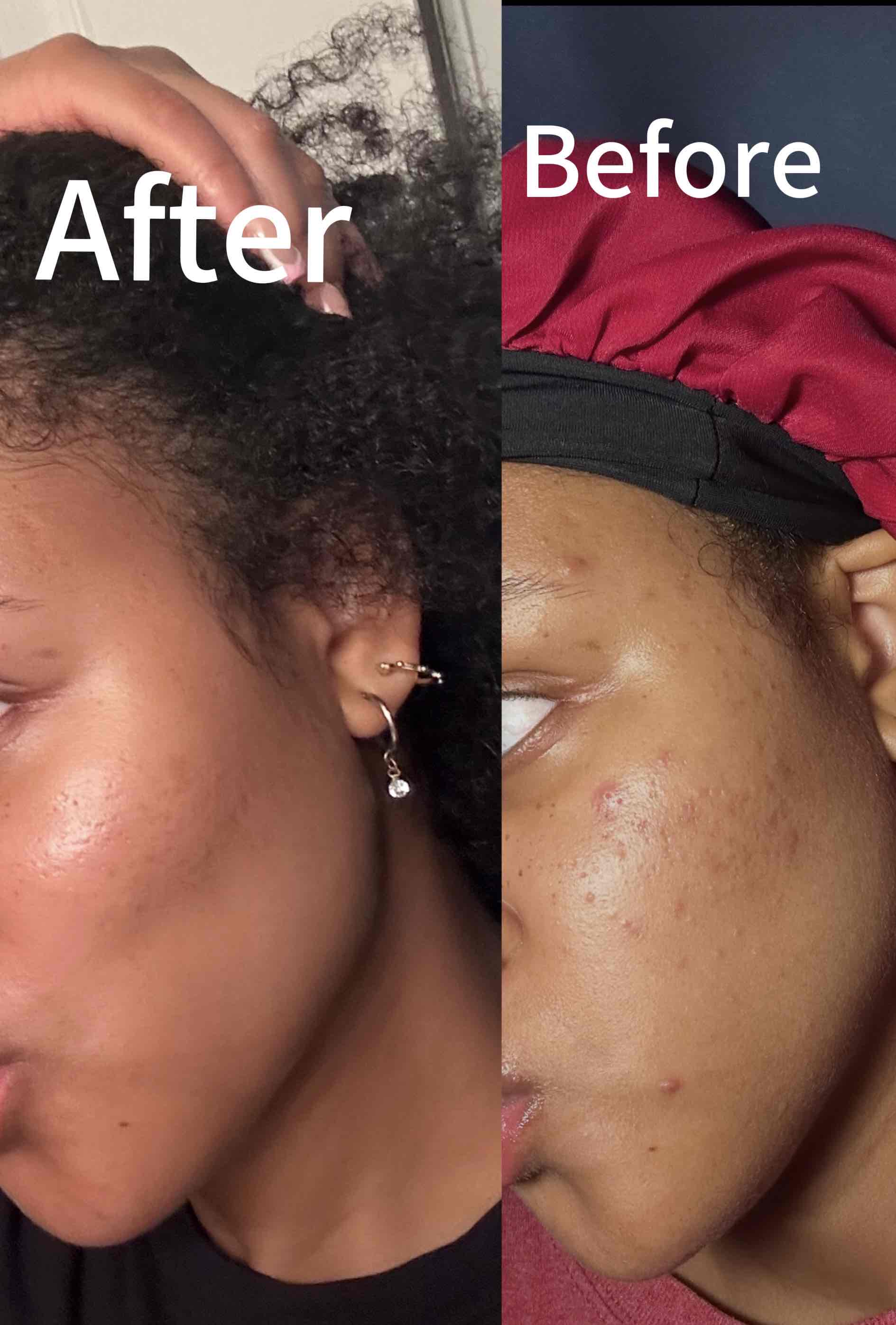 I would cry if these skincare products never exist 😅👏🏽 cover photo collage