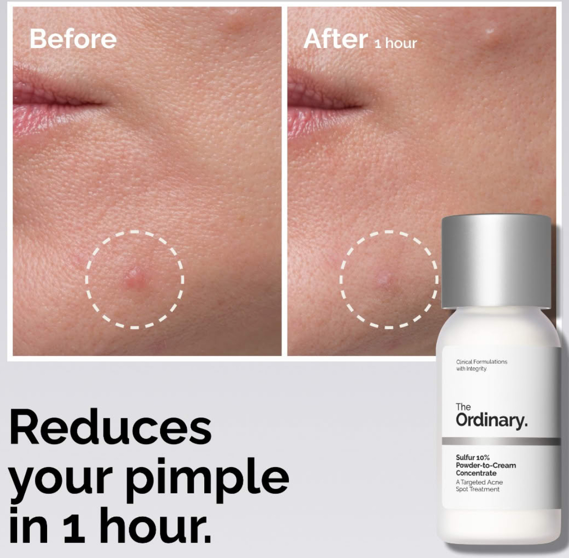 Budget Skincare That Never, Ever Lets Me Down cover photo collage